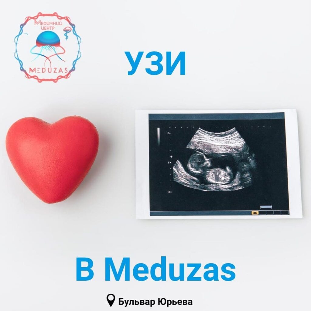 Врач УЗИ-диагностики MEDUZAS проводит исследование пациенту в Харькове